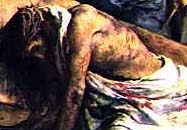 Jesus was severely beaten.